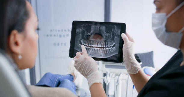 Licensed Tooth Extraction service in San Diego, CA - Smile Center Dentistry